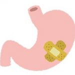 胃ガン・胃潰瘍